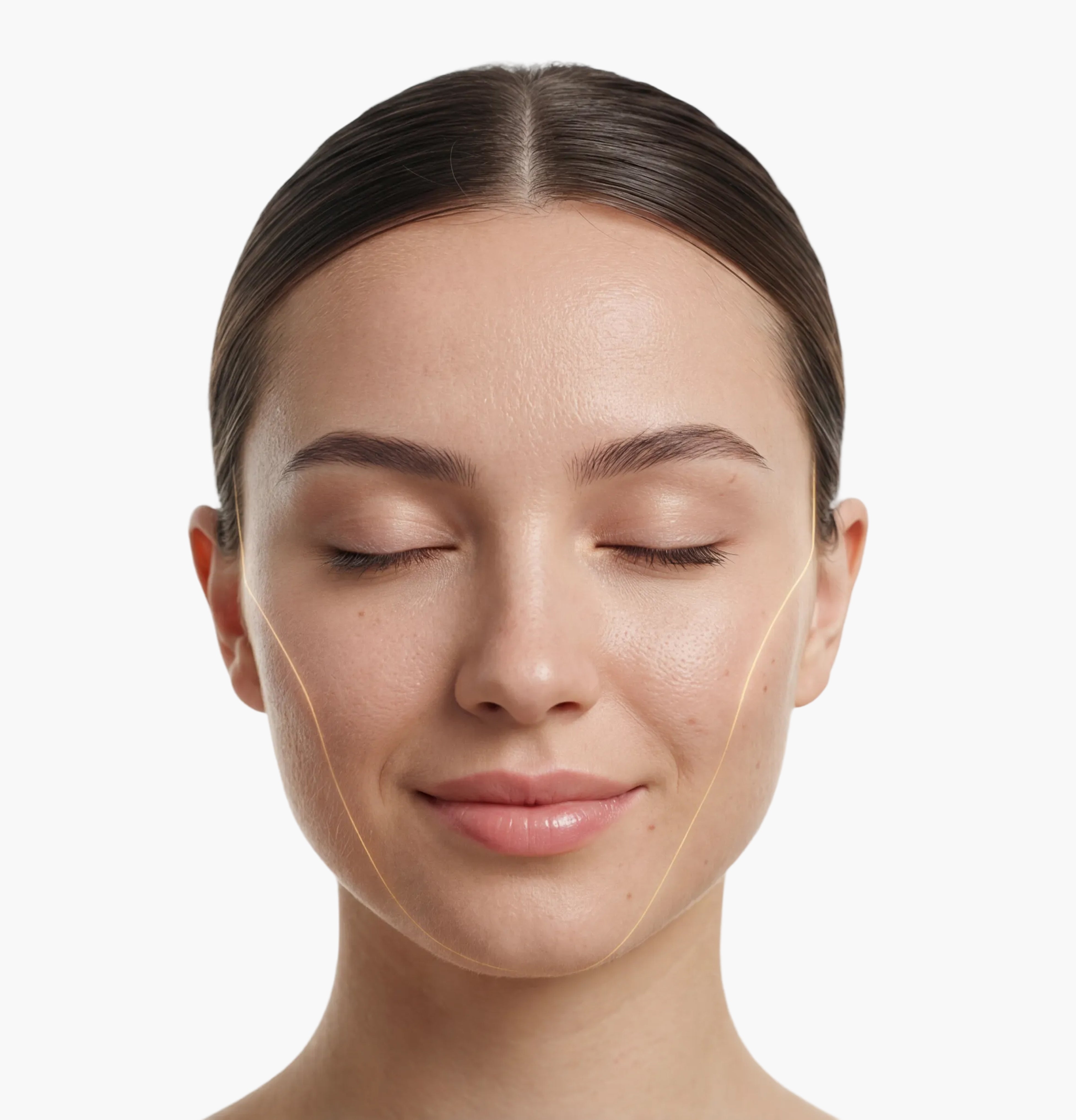 Woman with lines on her face to indicate skin treatment areas on a white background